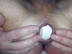 Baseball in my asshole